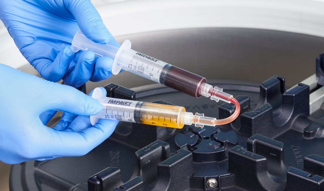Was ist PRP-Therapie?