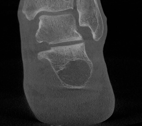 Instagram-Beitrag von Ortho4Sport